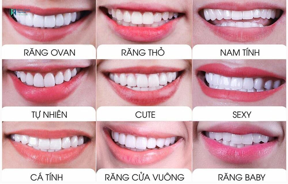 Top 10 mẫu răng đẹp 2022 được người nổi tiếng lựa chọn