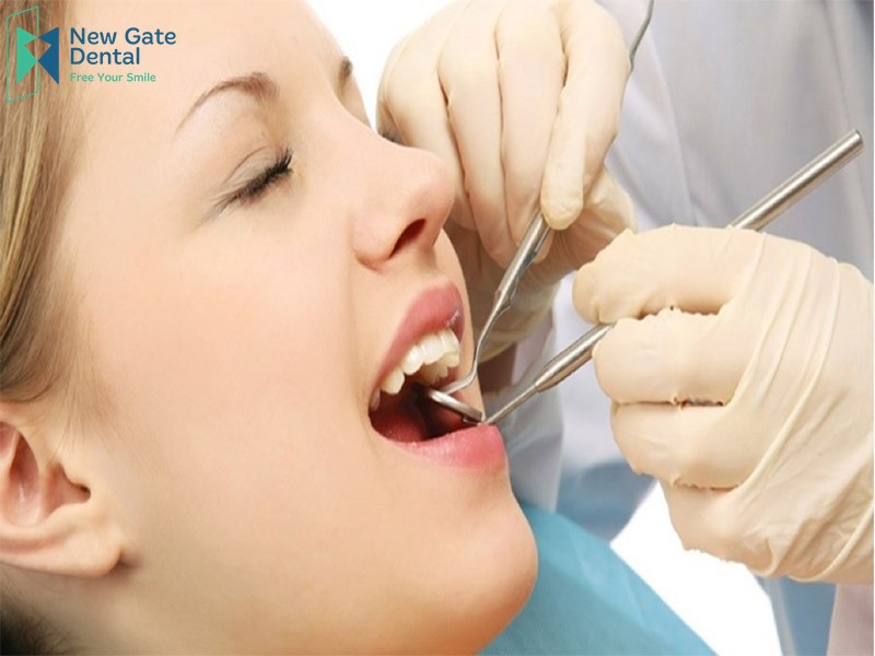 Nhổ răng có được bảo hiểm y tế không? Nho-rang-co-duoc-bao-hiem-y-te-khong-2
