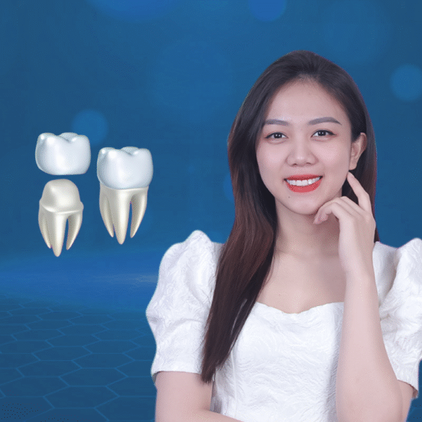 Khi nào nên bọc răng sứ