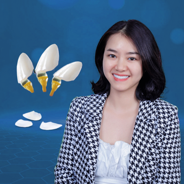 Niềng răng - Hình ảnh 2