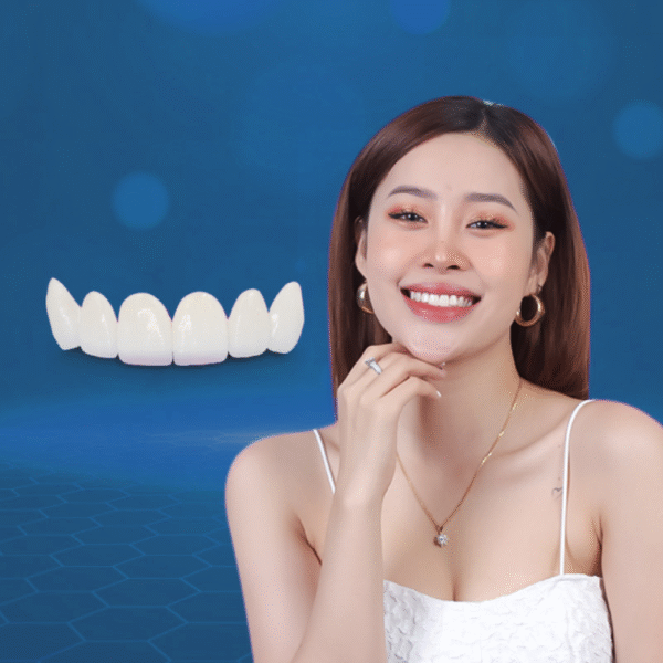 Trồng răng Implant - Hình ảnh 3