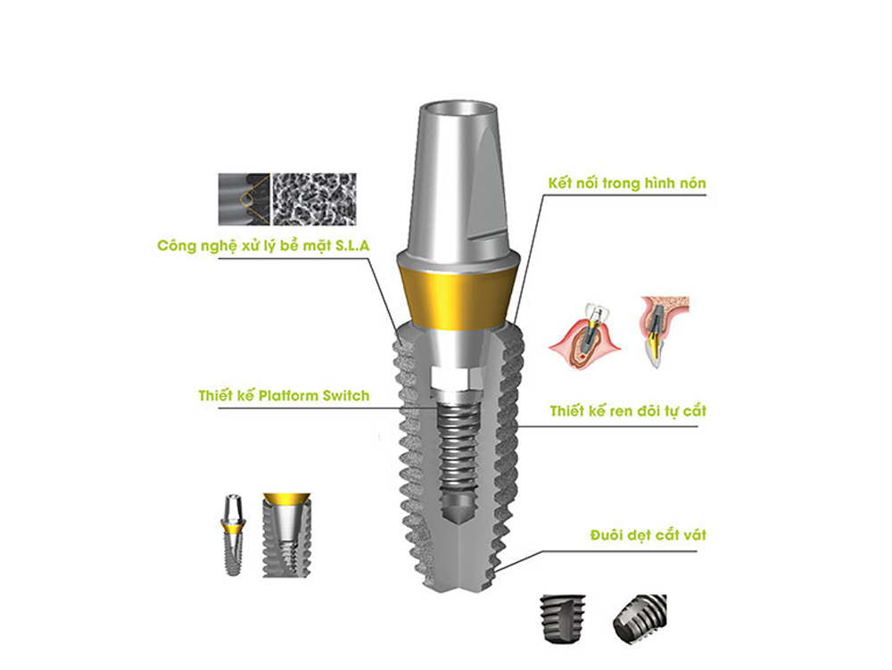 implant dentium