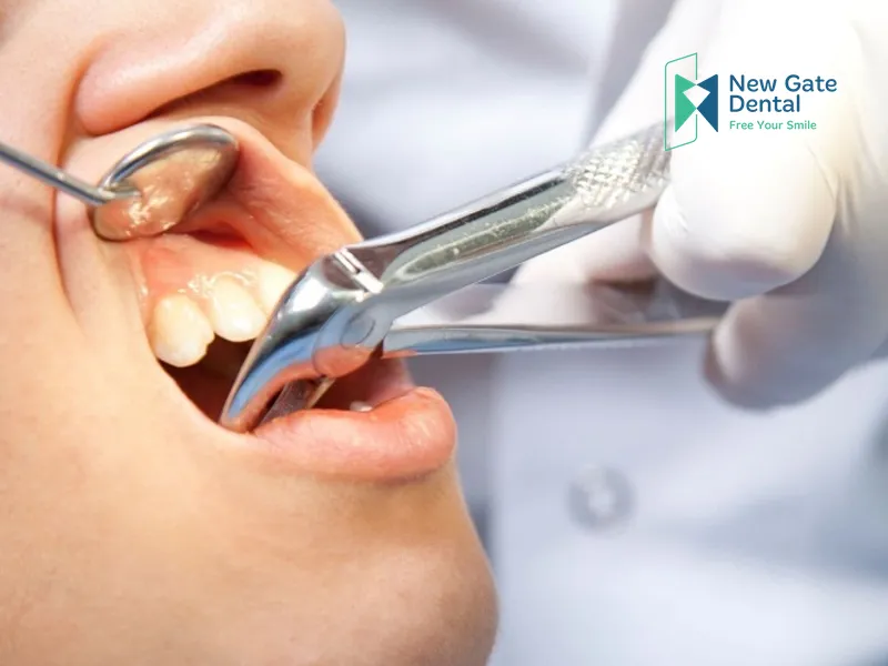 Frequently Asked Questions About What to Eat After Wisdom Tooth Extraction