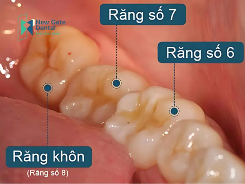 rang-khon-moc-den-nam-bao-tuoi2