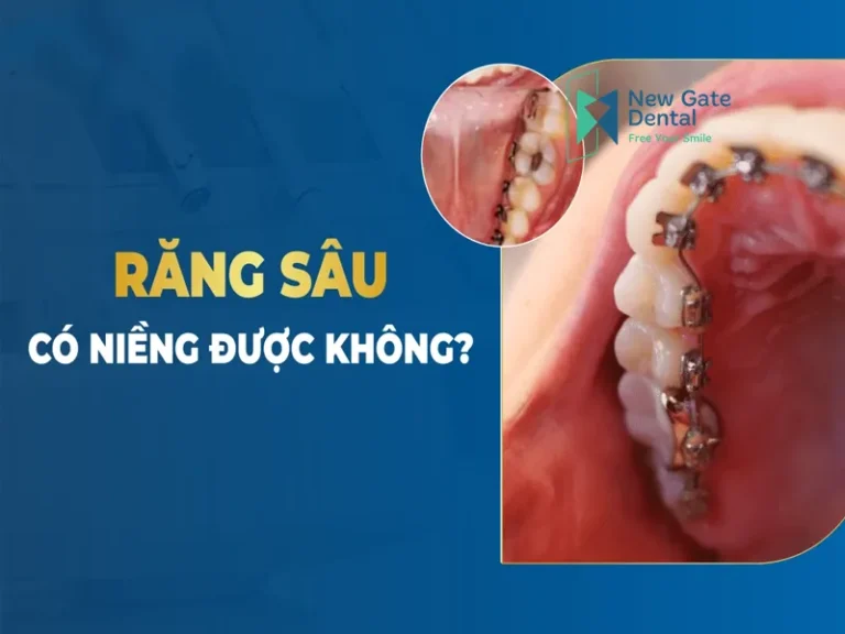 sau-rang-co-nieng-duoc-khong