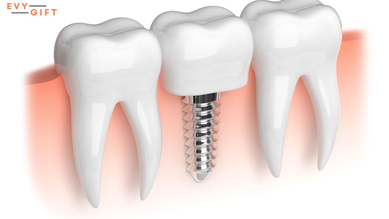 trồng răng implant có nguy hiểm không