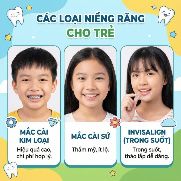 các loại niềng răng cho trẻ